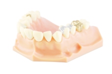 牙科模型（不同的处理）